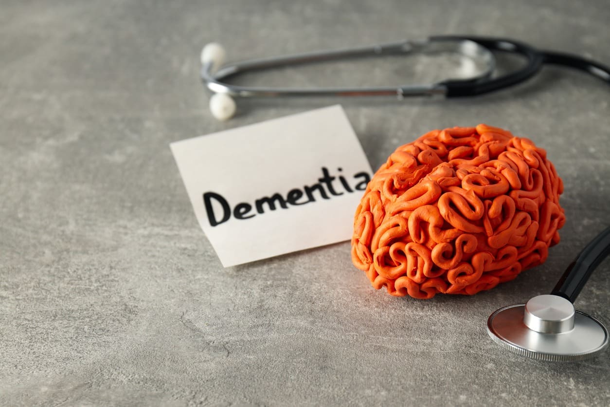 A model of a human brain, a stethoscope, and a paper with the word Dementia are arranged on a gray surface, symbolizing the medical concept of dementia.